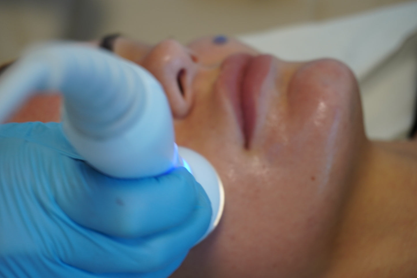Hydrafacial / Aqua Facial